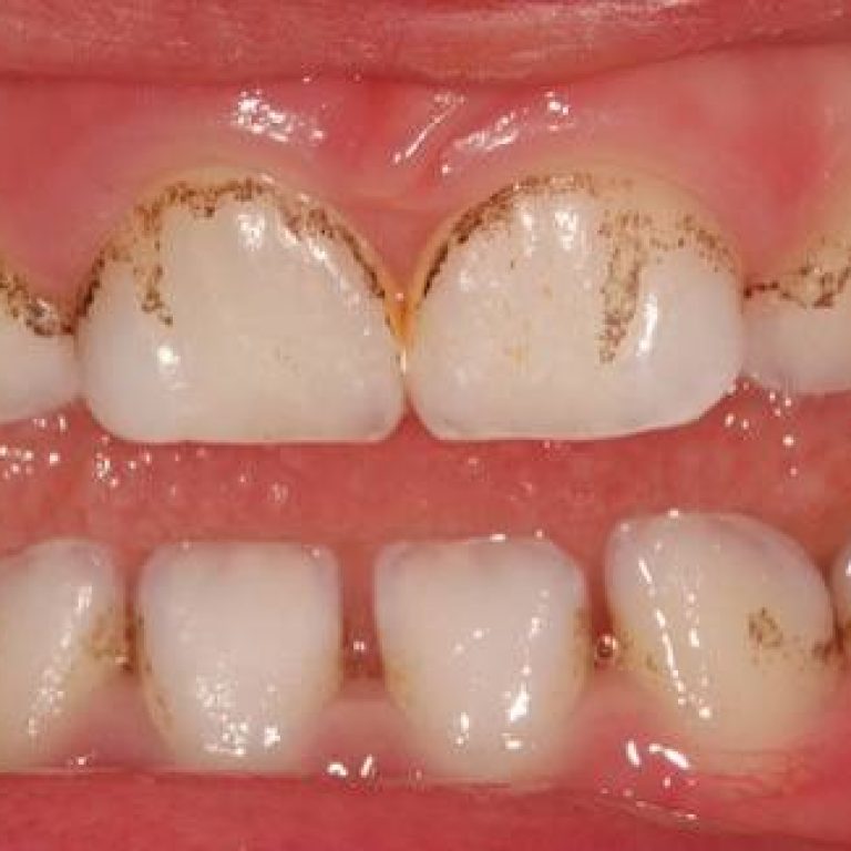 bacterii cromogene 1